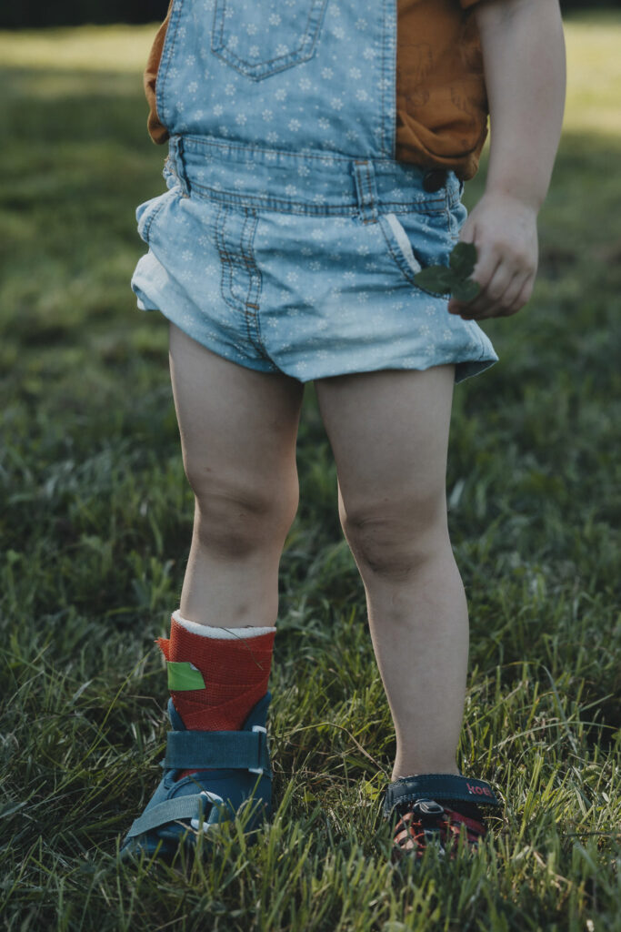 Kind in einer blauen, kurzen Latzhose. Auf einem Bein trägt es einen roten Gips. In der anderen Hand hält es ein Kleeblatt.