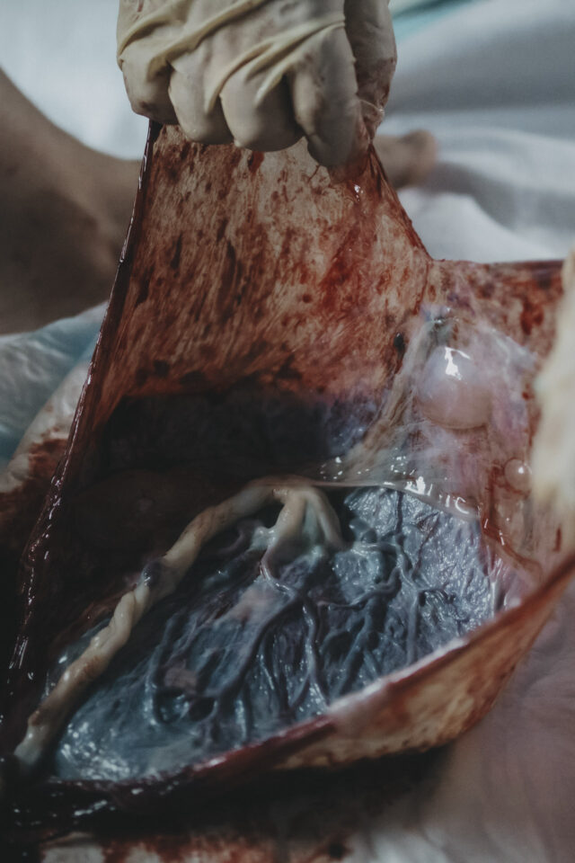 Plazenta nach einer Geburt.