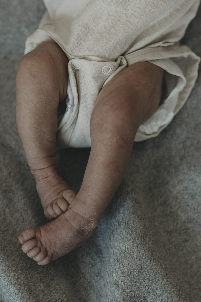 Nackte Babyfüßchen, mit trockener Haut, die sich kurz nach der Geburt löst.